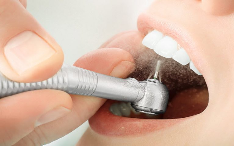 Мифы и факты о кариесе