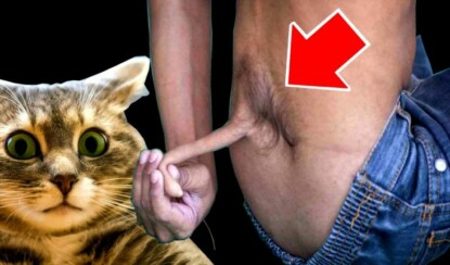 Десять самых бесполезных человеческих органов