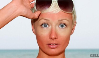 Солнечный ожог: 4 лайфхака, как от него избавиться