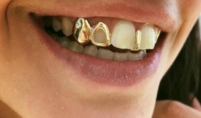 Зачем раньше вставляли золотые зубы